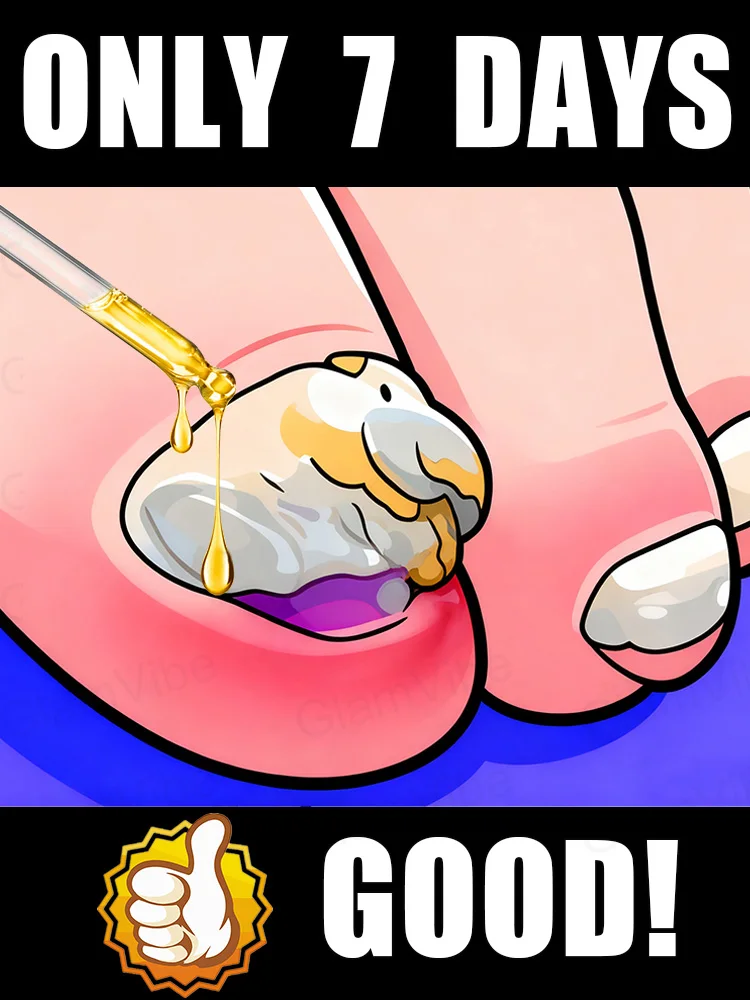 

Qᴜɪᴄᴋ Tʀᴇᴀᴛᴍᴇɴᴛ, Sᴀʏ Gᴏᴏᴅʙʏᴇ ᴛᴏ Fᴜɴɢᴀʟ Nᴀɪʟ Wᴏʀʀɪᴇs