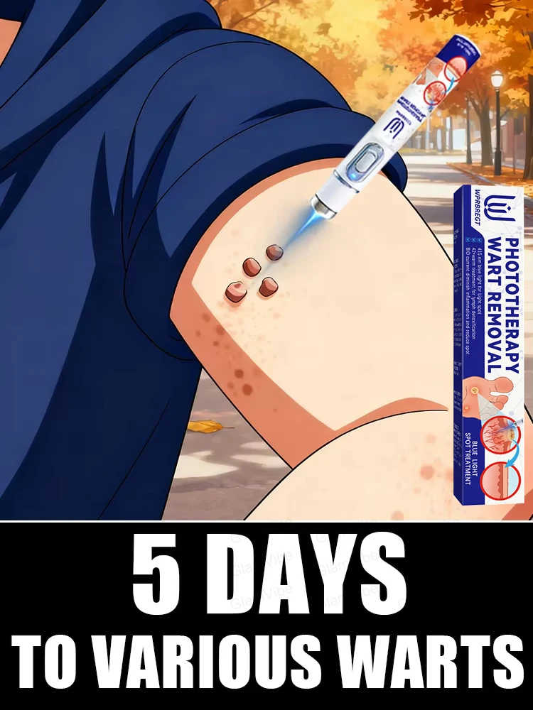 

Новое обновление 2025 года, синий лазерный инструмент для решения бородавок