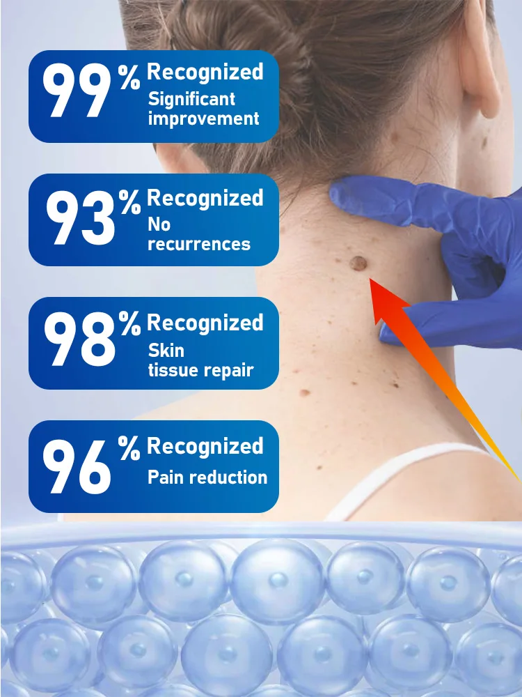 Technology changes life and Bestselling body tools, wart removal body tools, little blue bottle Free shipping,Unisex