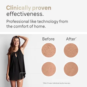 IPL Laser Derper for Women, Hair Sideboard, Men's Shaver, Electric Shaver, Bikinis, Razor, Gym, Haircut Machine Main Men's Hot sales - №5