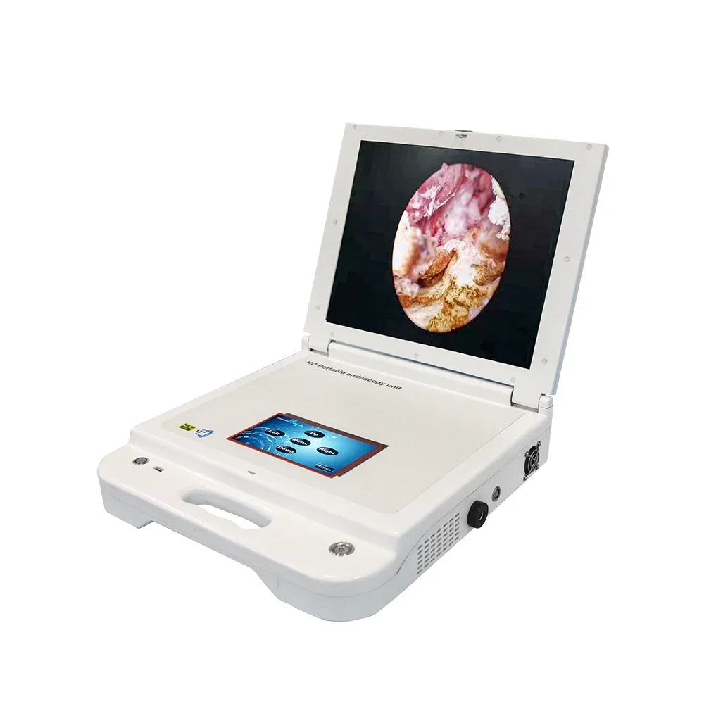 

Медицинский модуль заводского производства Шрек Портативная HD-камера Цена 17 дюймов