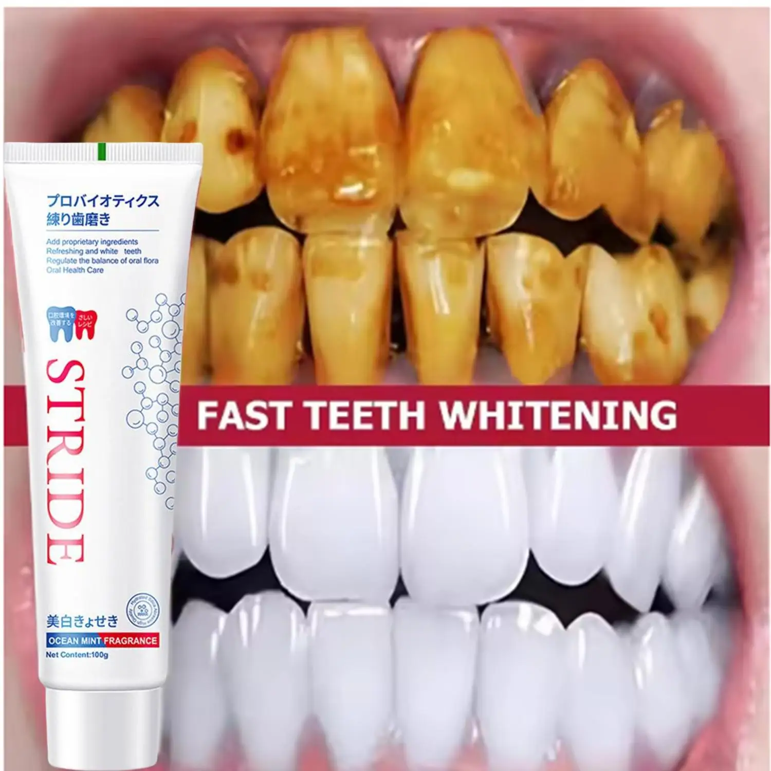 100g Probiotic Toothpaste Whitening Teeth Plaque Stain Remover Tooth Whitener Oral Hygiene Cleaning Fresh Breath Dental Product