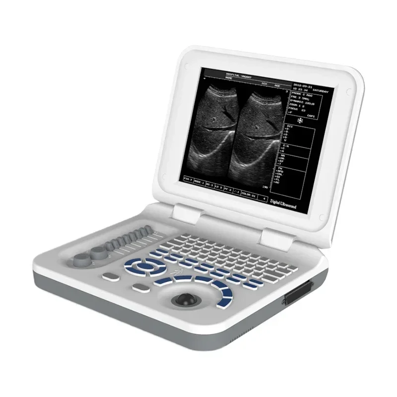 

MN-S30 Medical B/W Full Digital Ultrasound Scan Portable Laptop Ultrasound Machine