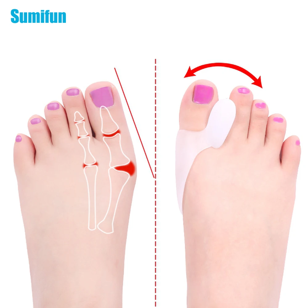 

2/4/6Pcs Silicone Big Toe Separator Bunion Foot Pad Hallux Valgus Corrector Toe Overlapping Bone Insole Foot Health Care Tools
