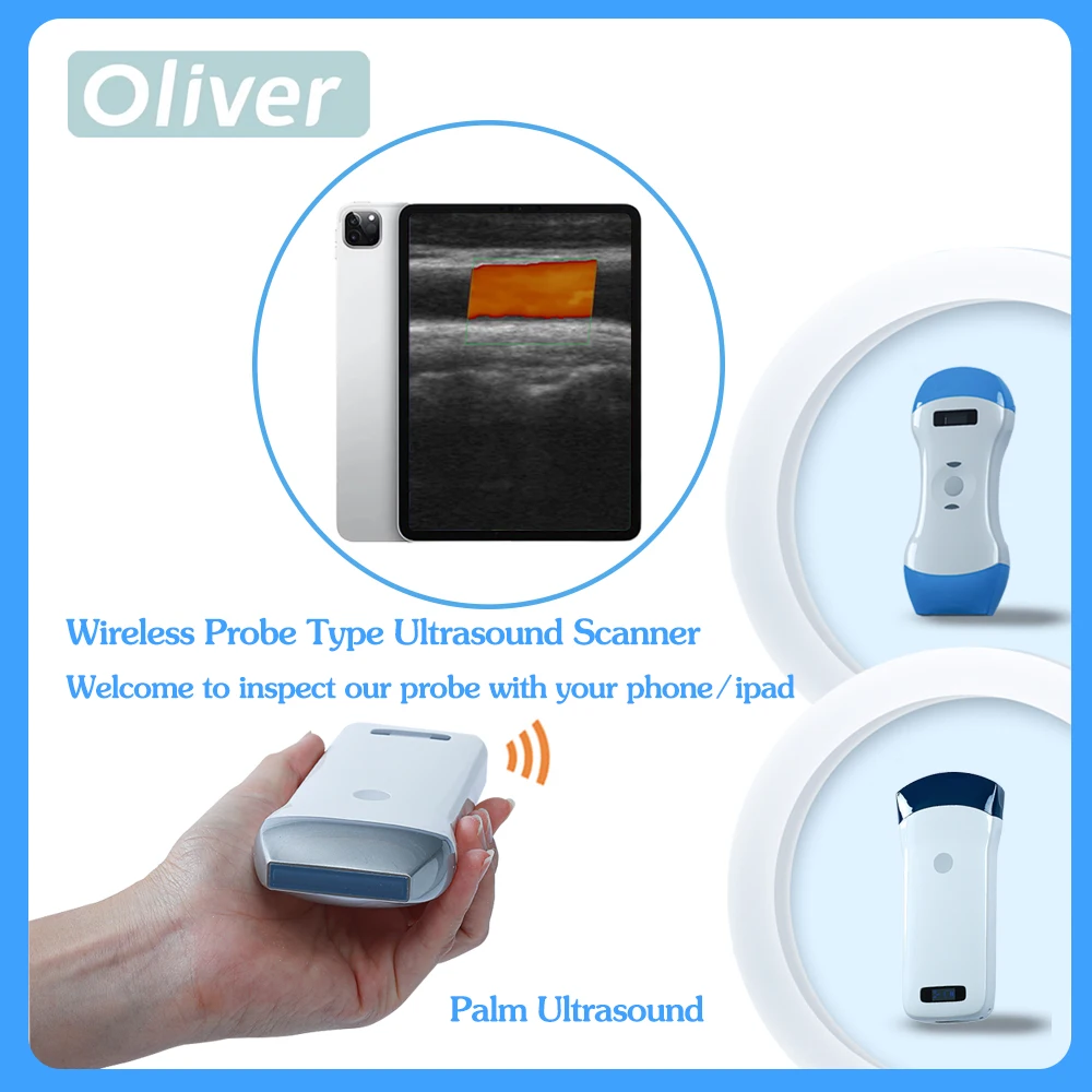 USG Wireless Ultrasound Probe scanner portable Bluetooth machine WIFI ultrasound scanner Machine support iOS Android Windows