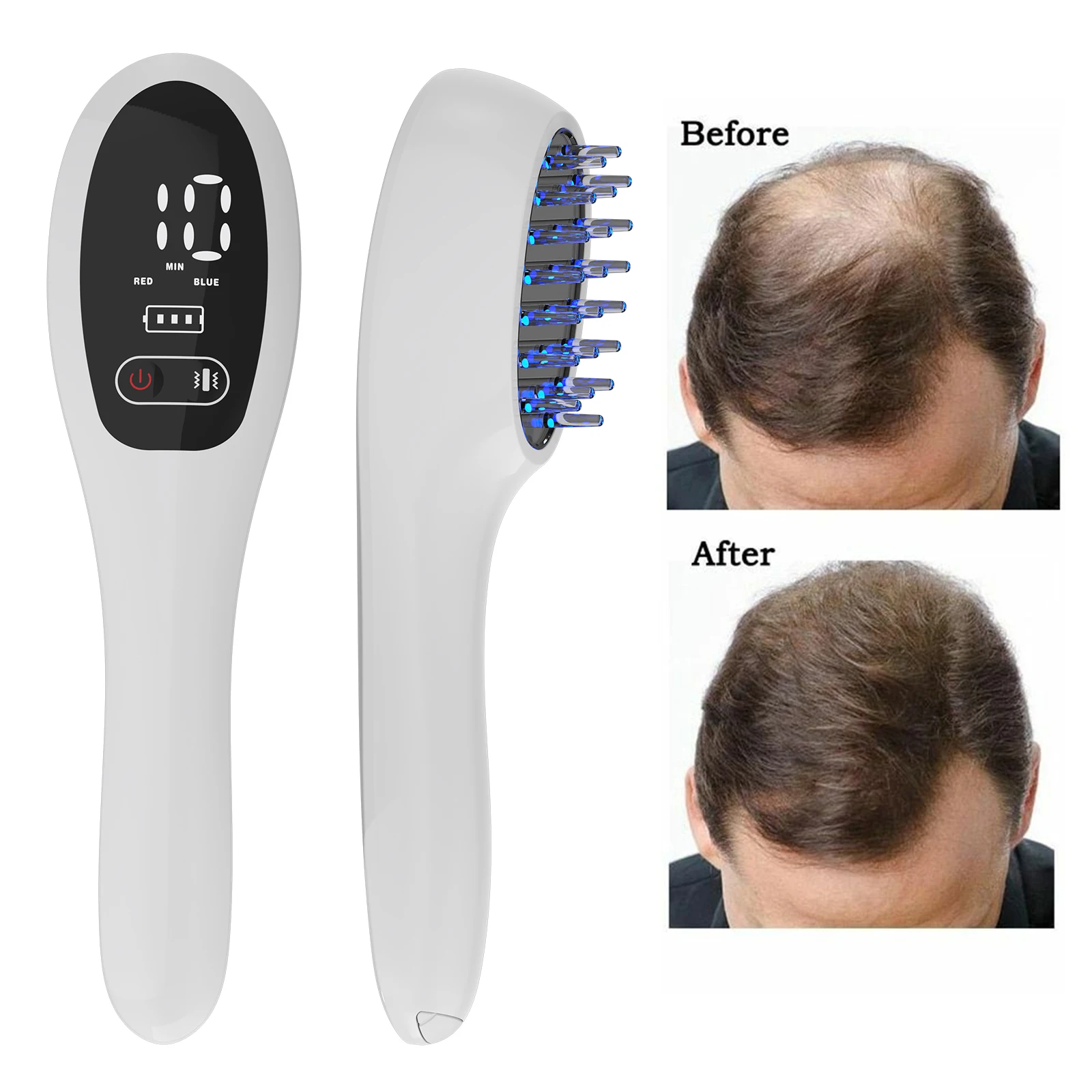 Medical Grade Red Blue Light Hair Growth Comb Electric Scalp Massager Anti Hair Loss Phototherapy Laser Portable Hair Brush