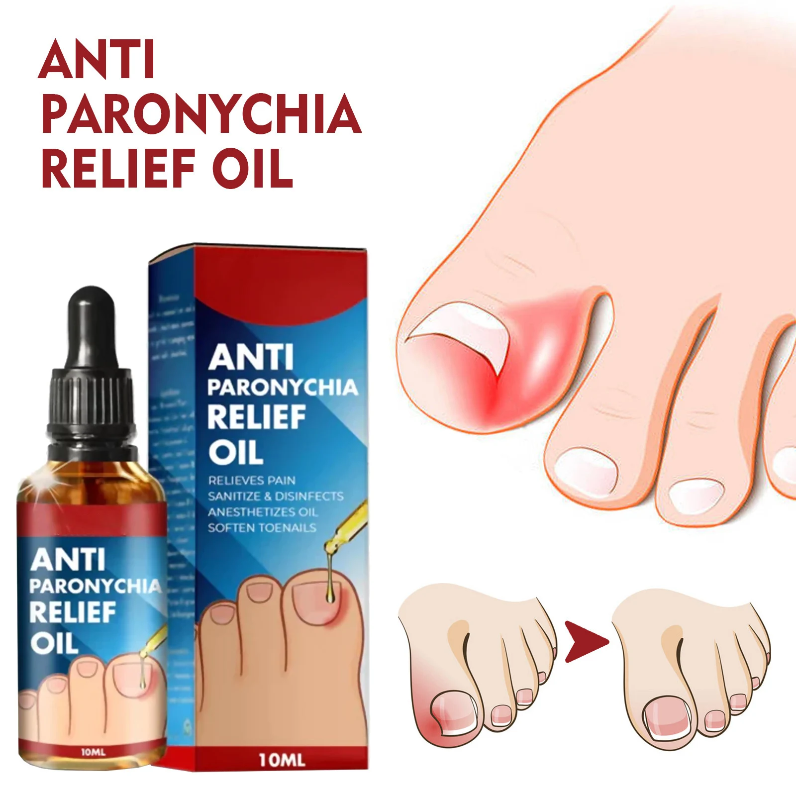 Ingrown Toenail Tratamento Óleo, Nutritivo Força, Unhas Tratamento, Pain Reliever, hidratação para amarelamento, espessamento Chipping, fácil aparar