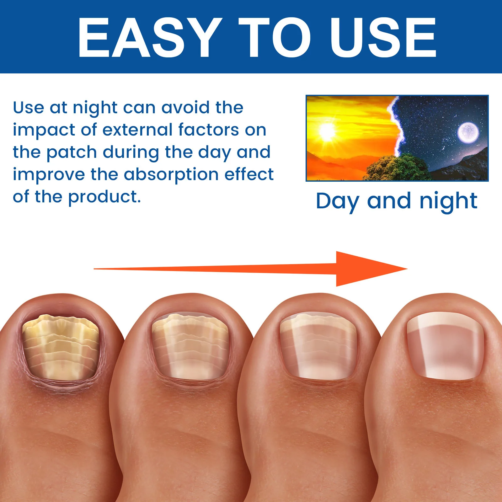 Remendo de tratamento de unhas nutre profundamente repara unhas danificadas unhas fungas cinza espessamento macio paroníquia tratamento adesivos