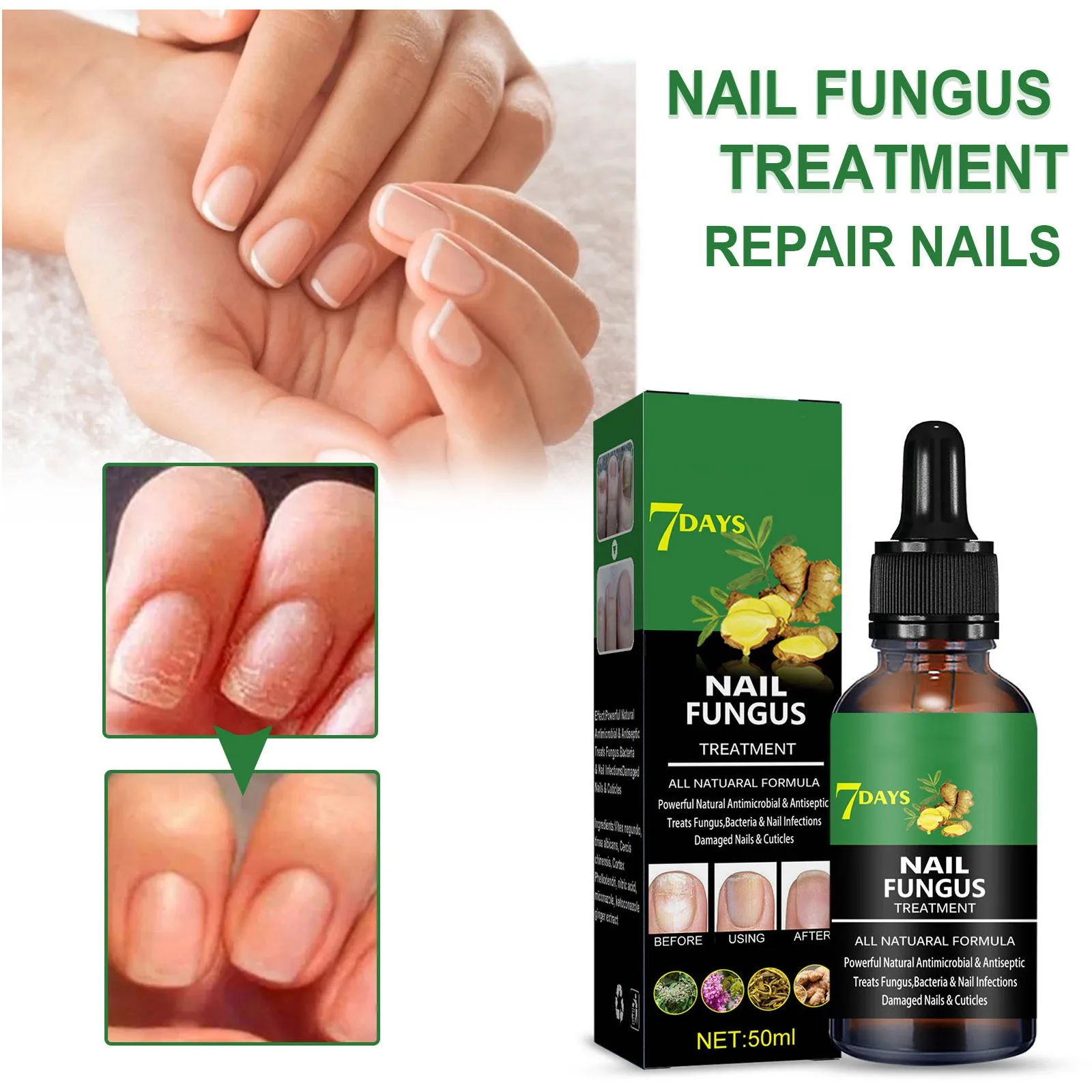 Intense Nail Growth And Strengthening Serum 7 Days Nail Growth And Strengthening Serum Nail Strengthener For Thin Nails