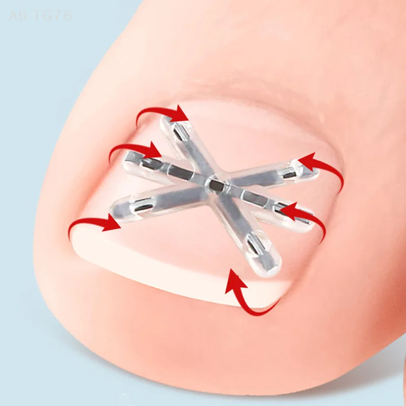 مجموعة أدوات تصحيح أظافر القدم الغارزة مكونة من قطعتين مع أدوات باديكير لاصقة مرنة لاستقامة وعلاج أظافر القدم