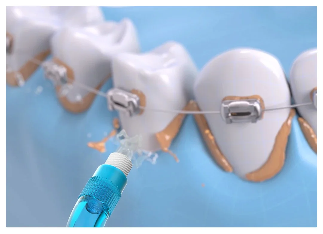 For Soocas W3 Jets … - image