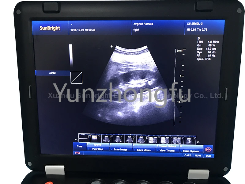 Ultrasound scanner machine for pregnancy/OB/GYN 128 elements portable 3D 4D color doppler