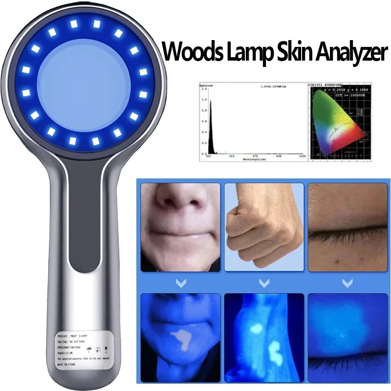 Skin Analyzer With Woods Lamp Portable Vitiligo Detector Analysis Machine LED Rechargeable Lights For Home Use Equipment