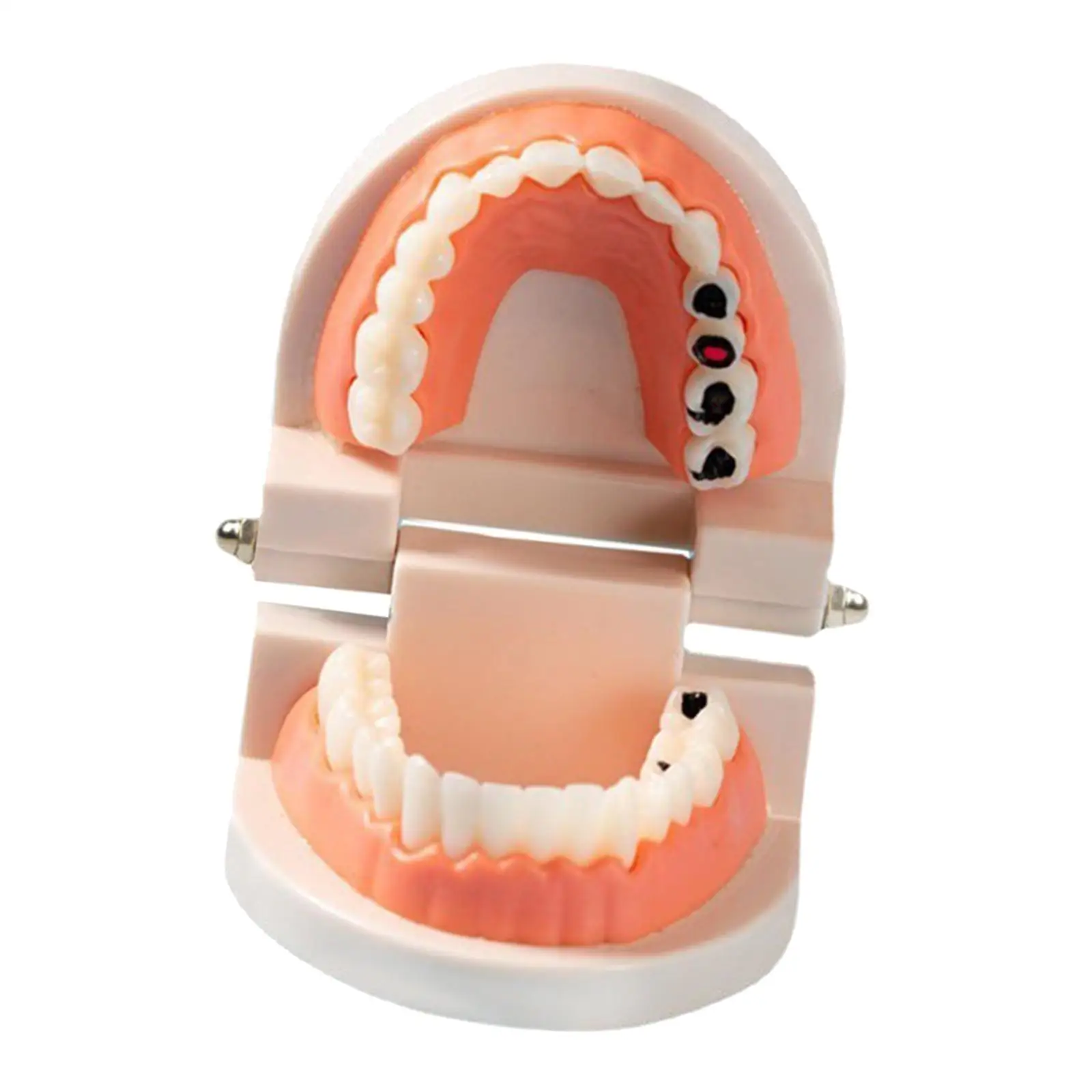 Sumulation Decay Teeth Model Study Standard 28 Teeth Model for Brush Display