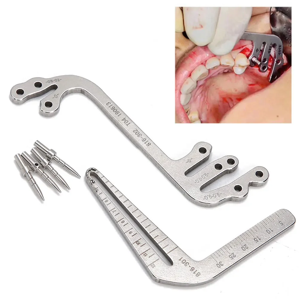 

Dental Implant Surgical Guide Set Oral Planting Drilling Positioning Ruler Angle Ruler Dentist Implant Guidance Appliance Tools