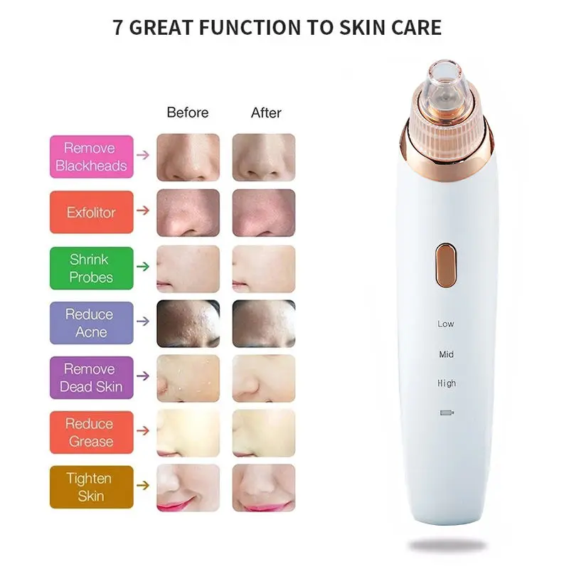 4 in 1 Blackhead Electric Facial Skin Care Pore Cleaner Beauty Tool