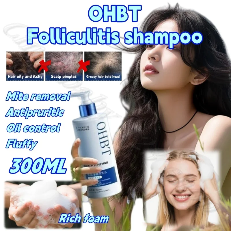 

OHBT Шампунь-лосьон с фолликулит для удаления клещей и отшелушивания кожи головы, очищения и контроля жирности, пушистый противозудный крем-шампунь