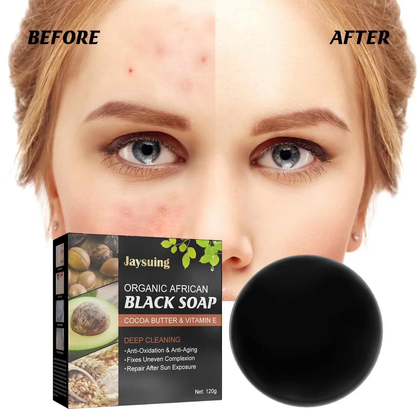 Jaysuing Mite removing cleansing soap removes acne, pimples, keratin, cleanses mites, smooth skin, face, body, handmade soap