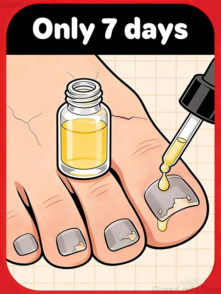 

Свидение, полезные новые ногти, выращиваются из корня, полностью обновлены.