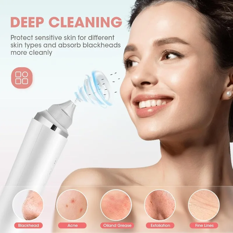 1080P HDカメラ付き黒ずみ除去ツール 黒ずみ除去器 6つの吸引ヘッド付き真空吸引器 3つのモード搭載 毛穴吸引ツール スキンケア用