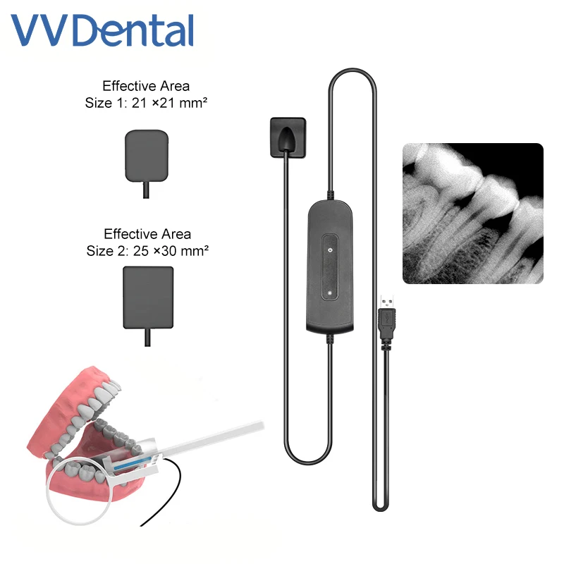 Sensor Digital portátil VVDental, Sensor Dental RVG, radiovisiógrafo de rayos X, sistema de imagen HD de alta frecuencia, herramientas de odontología