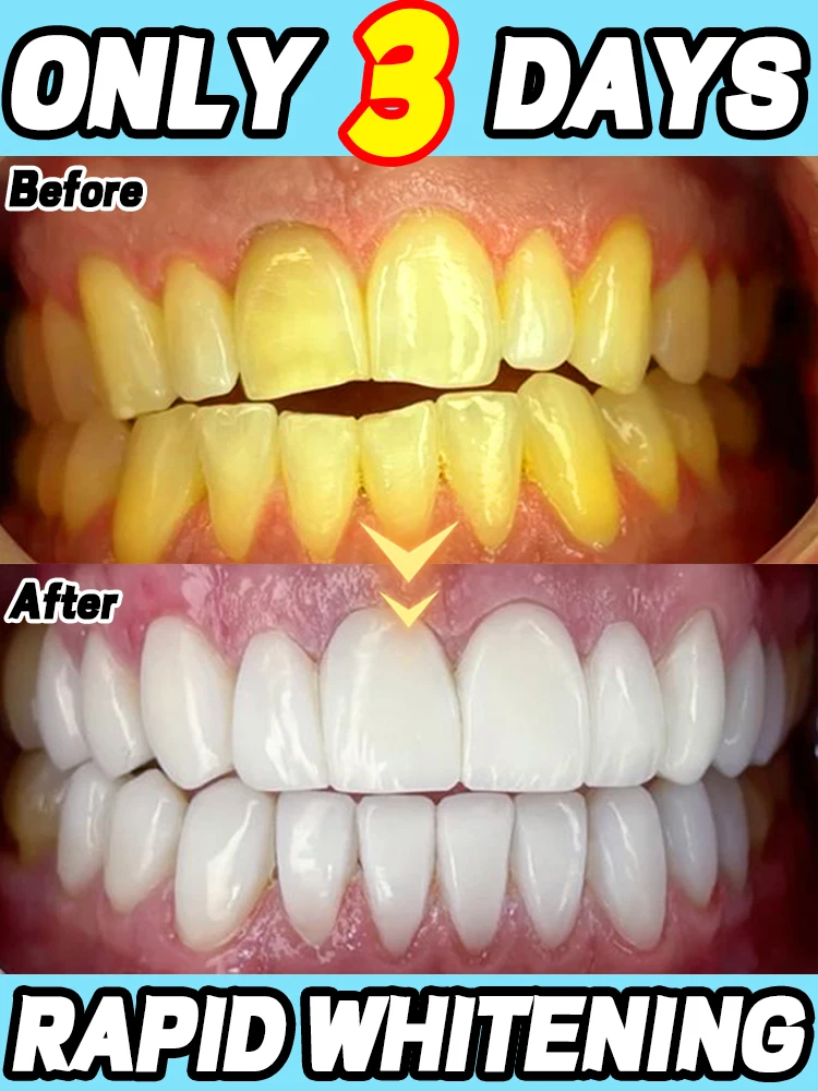 

Get white teeth easily