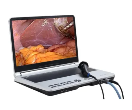 Portable Laptop Endoscopy  All in One Full HD Endoscope  System for Laparoscope, Hysteroscopes, ent with recorder