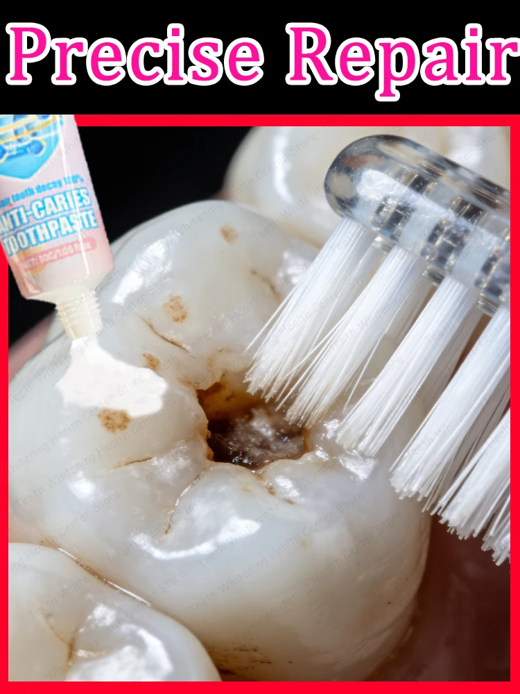 

Чистите зубы дважды в день, утром и вечером. Зубы могут быть восстановлены в течение 3 дней.