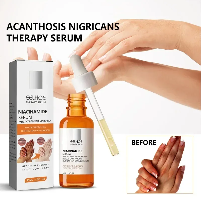 

Acanthos Skin Repair Essence fade armpit Knee joint dark Spots removal melanin whitening brighten Underarm body care Serum