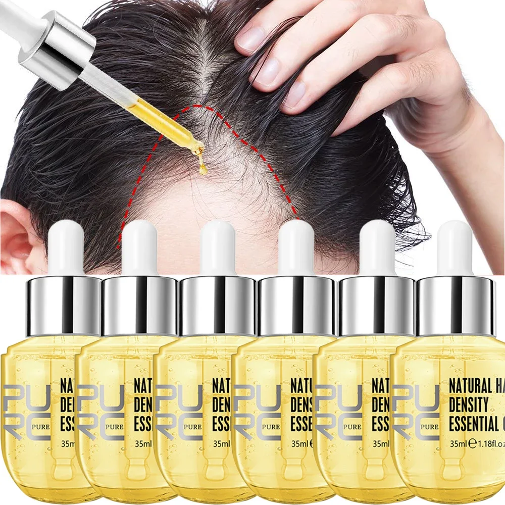 PURC 6PCS Fast Regrow Ginger Hair Growth Oils Hair Loss Treatment for Men Women For All Hair Types Hair Care Products