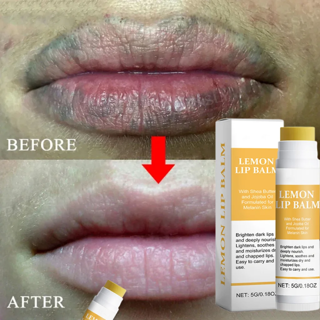 

Remove Dark Lip Balm Lightening Melanin Mask Gloss Oil Exfoliating Clean Moisturizer Korean Care Products Makeup Beauty care