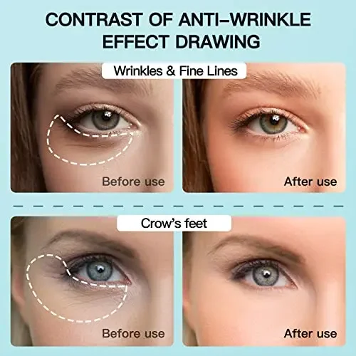 Microcurrent Facial Device, Eyes Skin Tightening, Anti Aging Device, Eye Bags, Eye Puffiness, Dark Circles, Crow's feet, Wrinkle