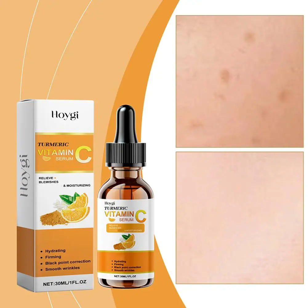 Turmeric Vitamin C Serum Remove Black Dots Lightening Whitening Moisturizing Brightening Tighten Smooth Skin Care 30ml