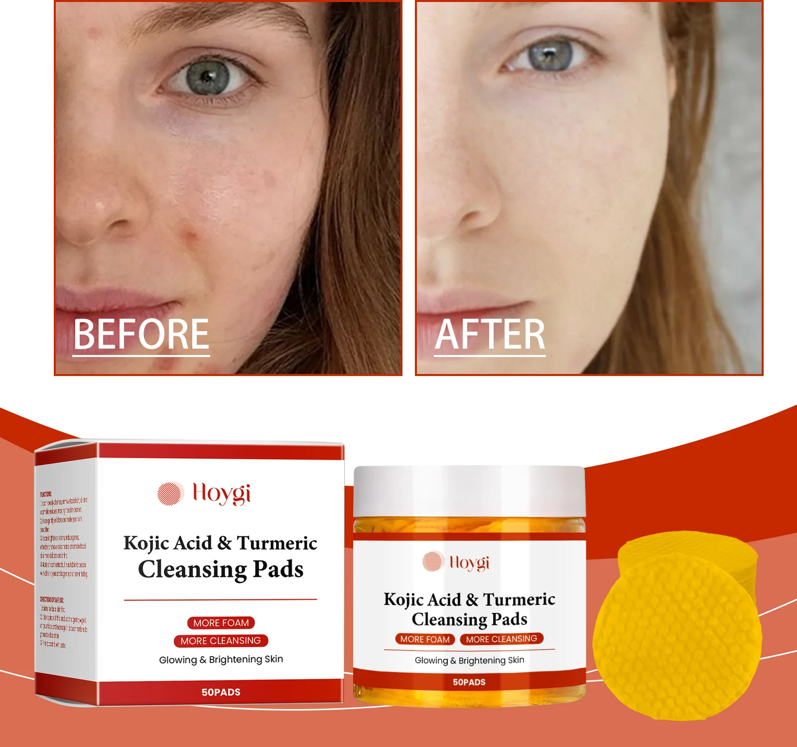 Almohadilla limpiadora de ácido kójico de cúrcuma Exfolia y limpia suavemente sin tensión, dejando la piel facial delicada y radiante