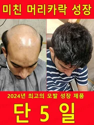 모발 성장 에센셜 오일, 대머리 및 탈모 치료에 효과적이며 피드백이 매우 좋습니다