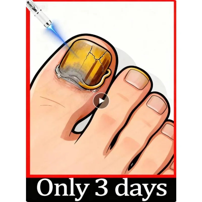 Holiday Sale, Nail Instruments, Nail Cleaning Tools