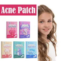 144pcs Mini Star Invisible Acne Removal Pimple Patch Beauty Face Acne Spot Face Pimple Acne Skin Concealer Tool Stickers