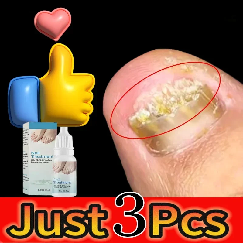 New Nail Fungus Treatment For Toenail Strength Repair Solution Hydrates Renew Damaged Discolored Foot