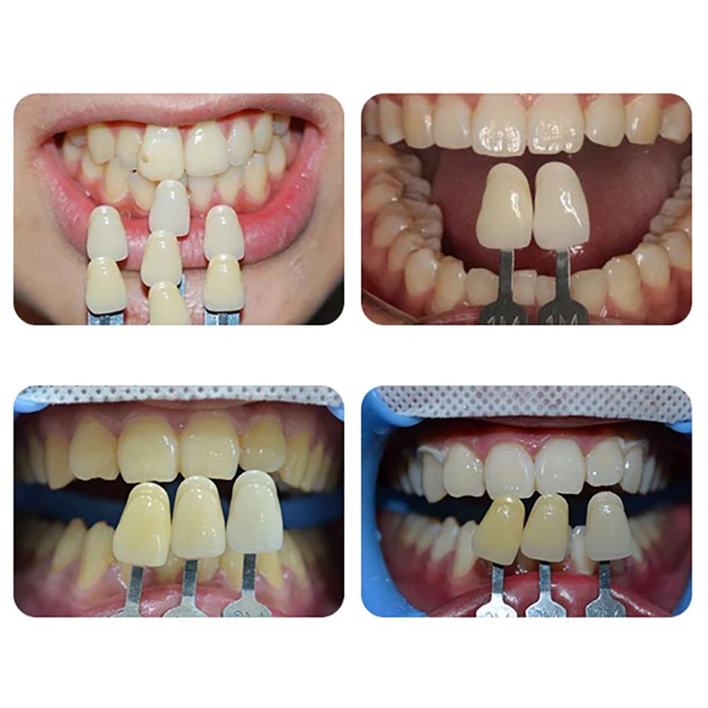 Vita Toothguide 3D Master Tanden Whitening Bleekmiddel Schaduw Gids 29 Kleuren Dental Lab Vergelijken Tandarts Kliniek Colorimetrische Plaat