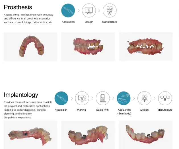 Fussen الأصلي S6500 الماسح الضوئي ثلاثي الأبعاد داخل الفم مع برنامج ثلاثية الأبعاد اللون الحقيقي مسح نموذج الأسنان التصوير لزراعة #6
