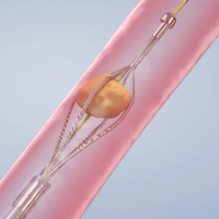 سلة استخلاص حجر المرارة ذات القناة الصفئية، سلة استخلاص الحجر العلوية والسفلية للمسار الهضمي للاستعمال مرة واحدة #4