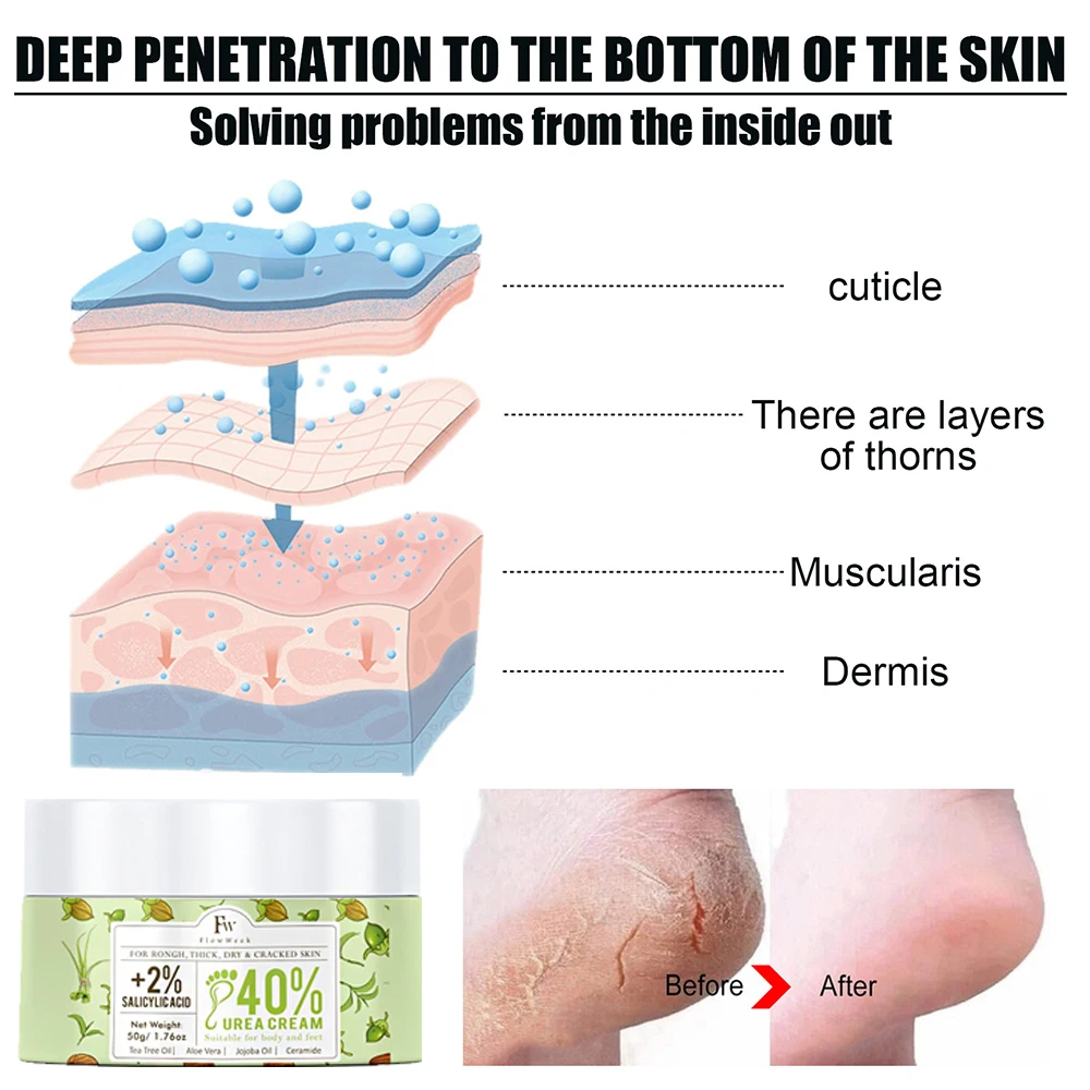 50g Anti Crack Foot Cream Anti-Drying Heel Cracked Repair Calluses Dead Skin Removal Moisturizing Hand Feet Care Beauty Health