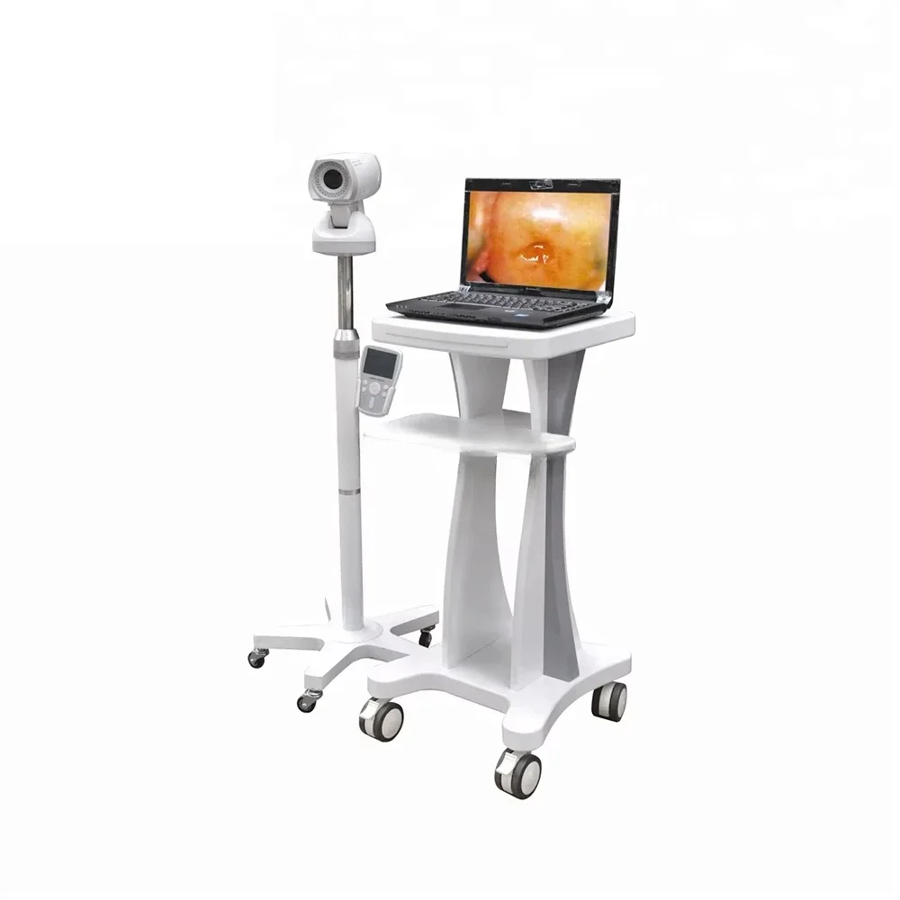 

LH9800A Colposcopy Gynecology full hd Digital Electronic Video Colposcopy for Gynecology/Colposcopy Machine