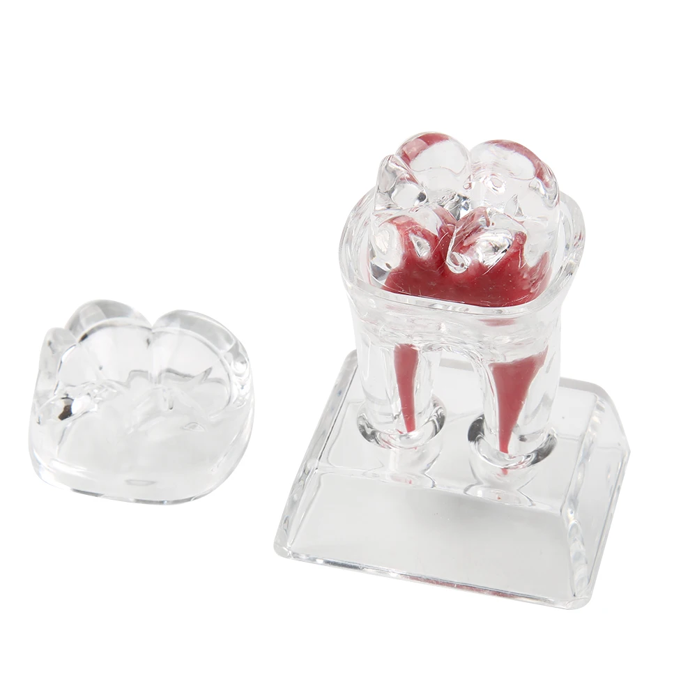 Dental Model Decomposable Dental Model Transparent Dental Teaching Model Transparent Small Ornament