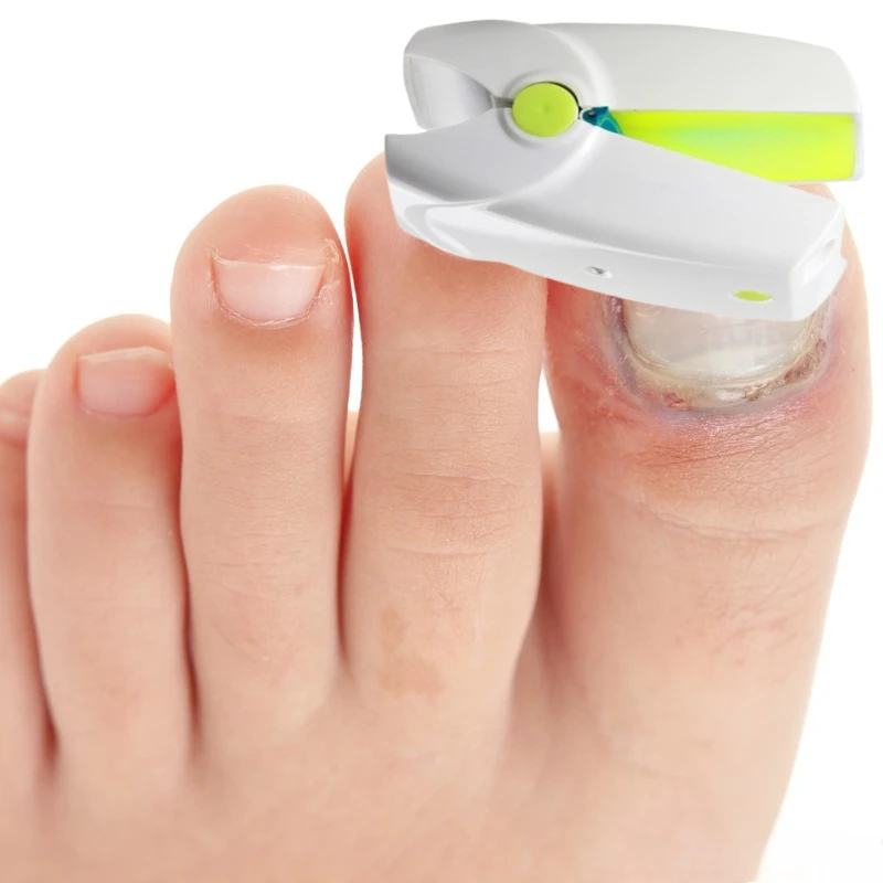 

Professional 905nm/470nm Nail Laser Device Fast Fungal & Ingrown Nail Treatment in Just 7 Minutes