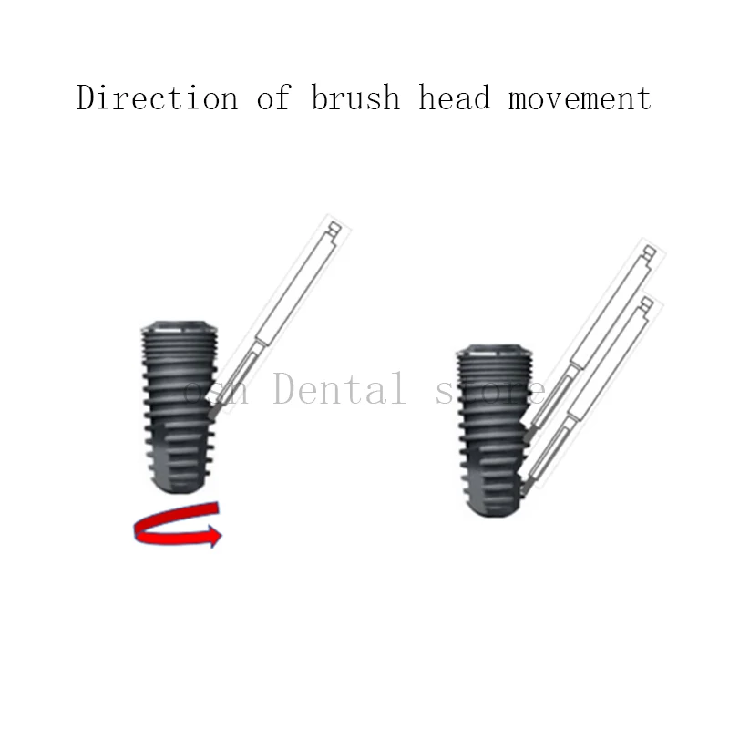 ASHUR 1Pc/Box 26/29mm Nickel Titanium Implant Cleaning Brush Mechanical Cleaner for Contaminated Implant Surface