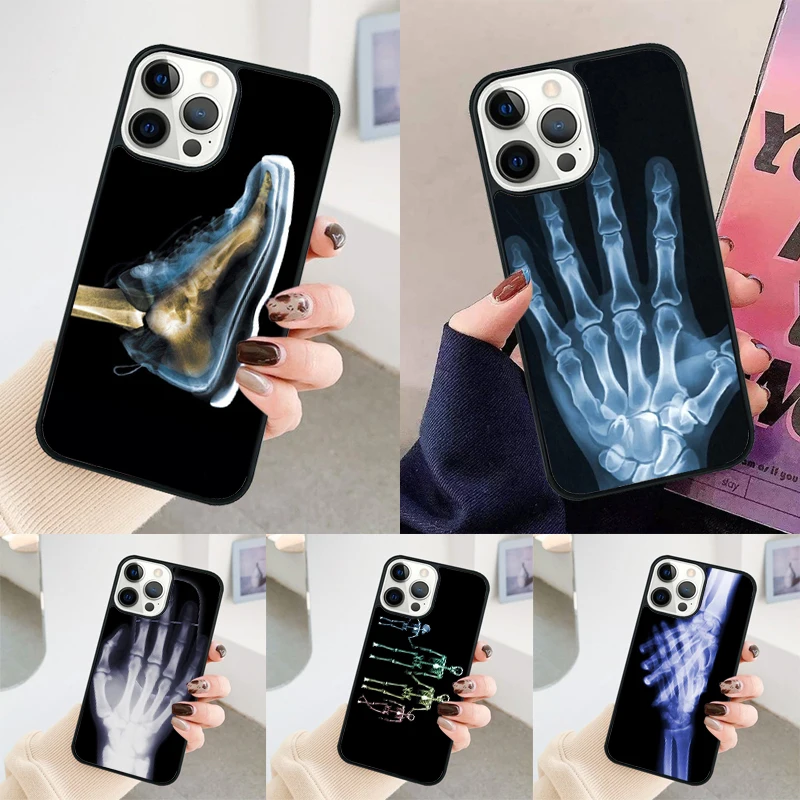 X-ray Hand Bones phone case Cover For iPhone 14 15 16 Pro Max SE 2020 coque For apple 11 12 13 Pro Max Mini 7 8 Plus