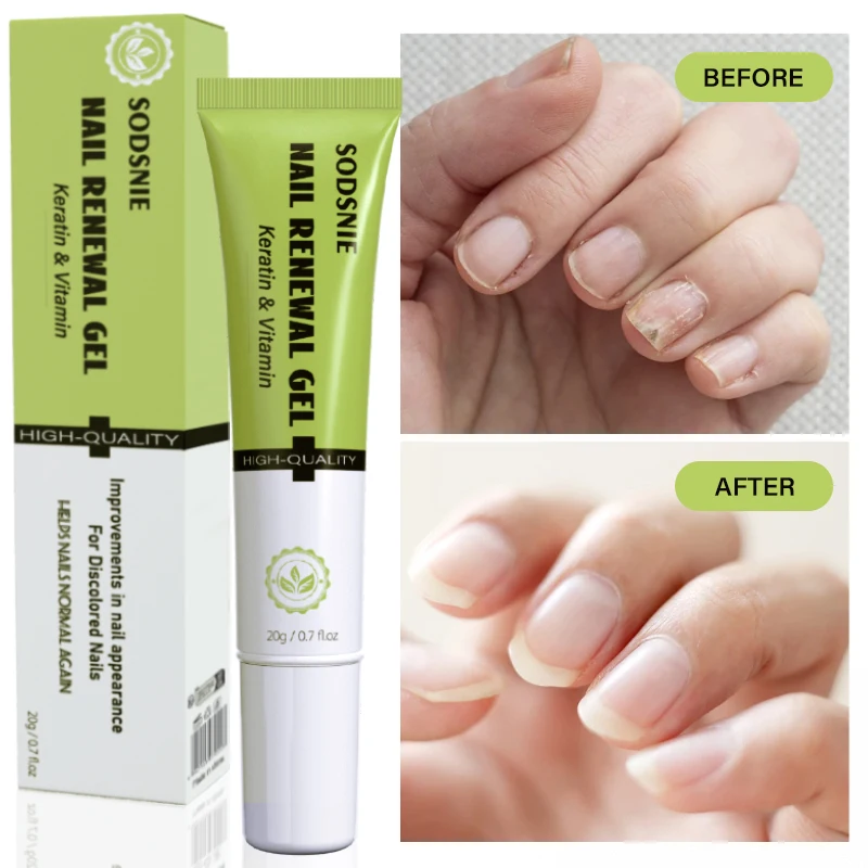 

Nail Renewal Gel Strengthen Nails Restore Normal Nails Moisturizing Natural Cuticle Nourishing Nails Healthy Nail Care 20g