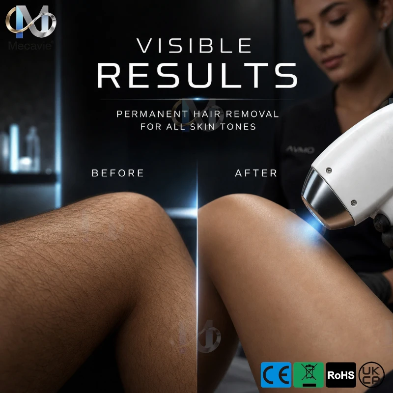 Professional 5000W Titanium Platinum Diode Laser Hair Removal Machine 4 Wavelengths 755nm 808nm 1064nm 940nm IPL Soprano Ice