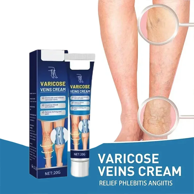 Varicose Veins Cream Relief Vasculitis Phlebitis Soothing Massage Cream for Legs Body Skin Care A081